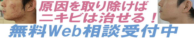 頑固なニキビの体内原因を見つけるまちだ美顔無料Web相談