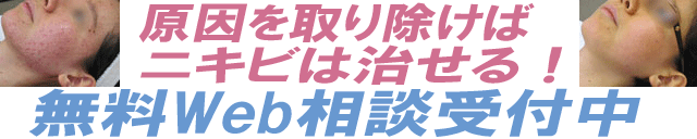 頑固なニキビの体内原因を見つけるまちだ美顔無料Web相談