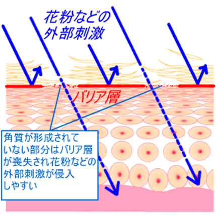 肌の乾燥でバリア機能が失われると花粉の影響を受けやすい肌になる