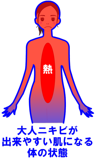 大人ニキビが出来やすい肌になる体の状態