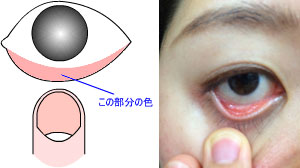 目の下の状態を撮影してファイル添付でお送りください