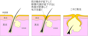 肌の働きが低下して新陳代謝が低下すると角質が正常に剥がれ落ちずに毛穴の目詰まりをおこしやすくなる