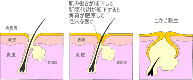 肌の働きが低下して新陳代謝が低下すると角質が正常に剥がれ落ちずに毛穴の目詰まりをおこしやすくなる