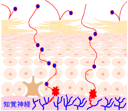 角質層が喪失されると知覚神経が刺激されます